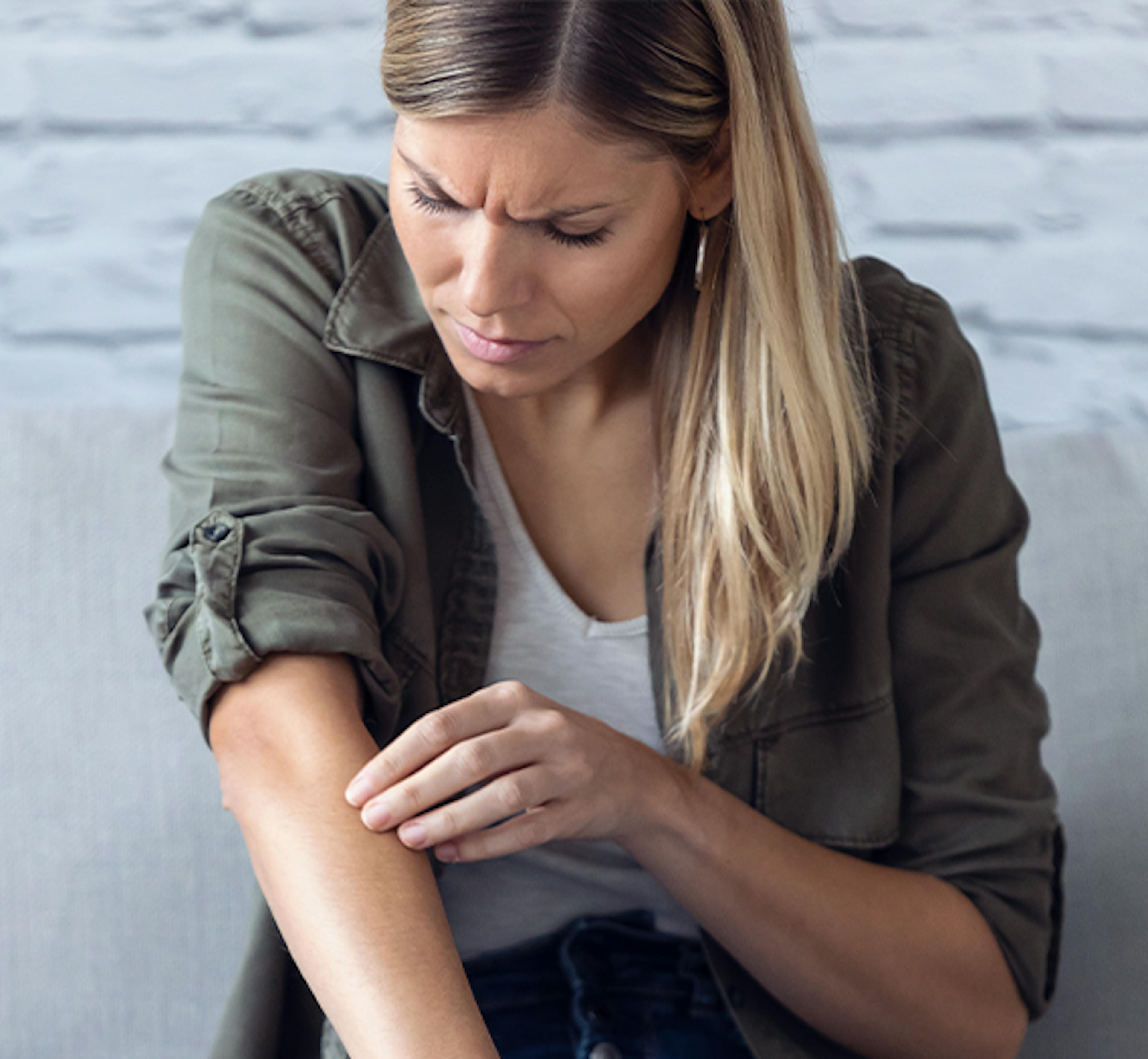psoriasis, eczeem, stress