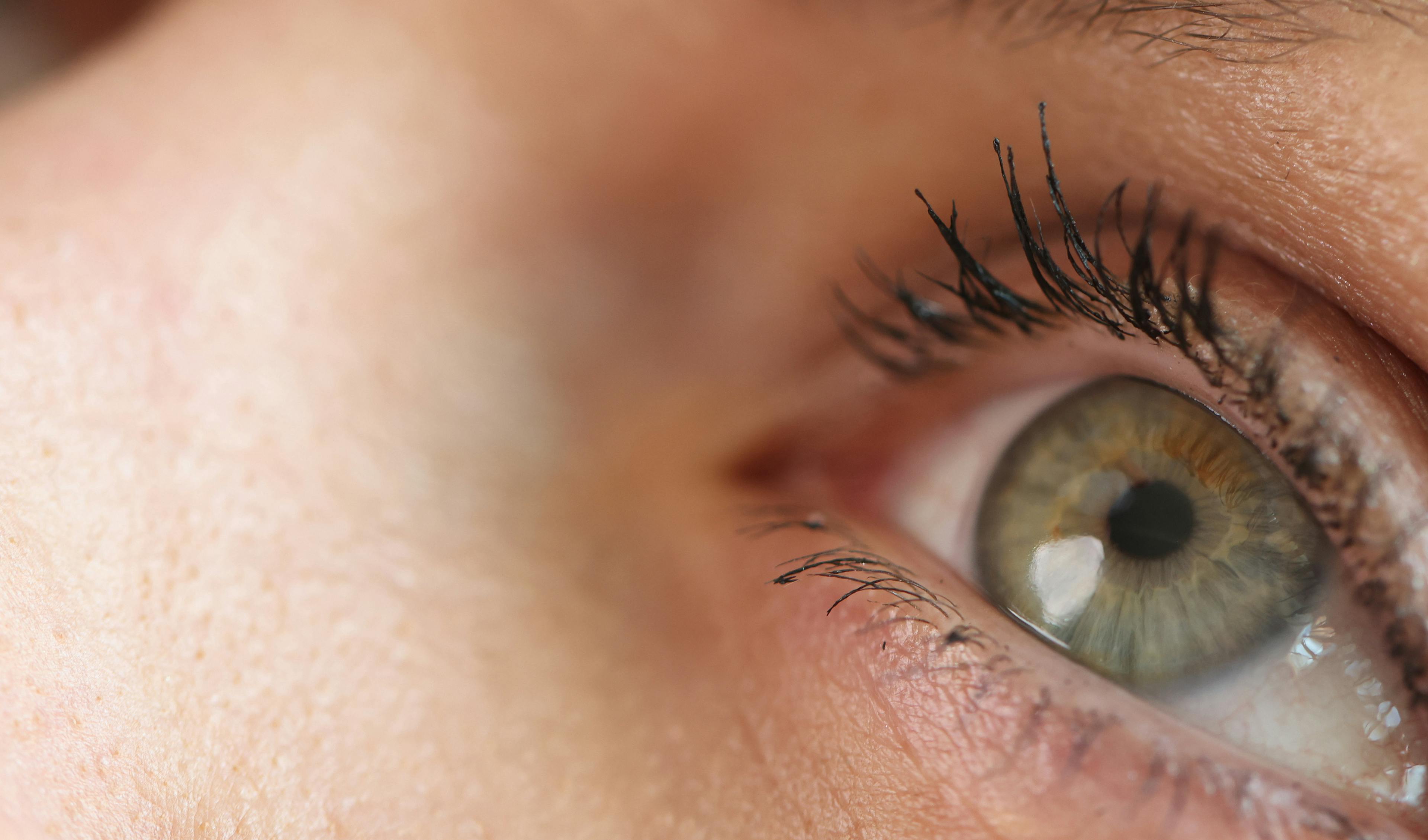 solutions naturelles pour soulager la sécheresse oculaire 