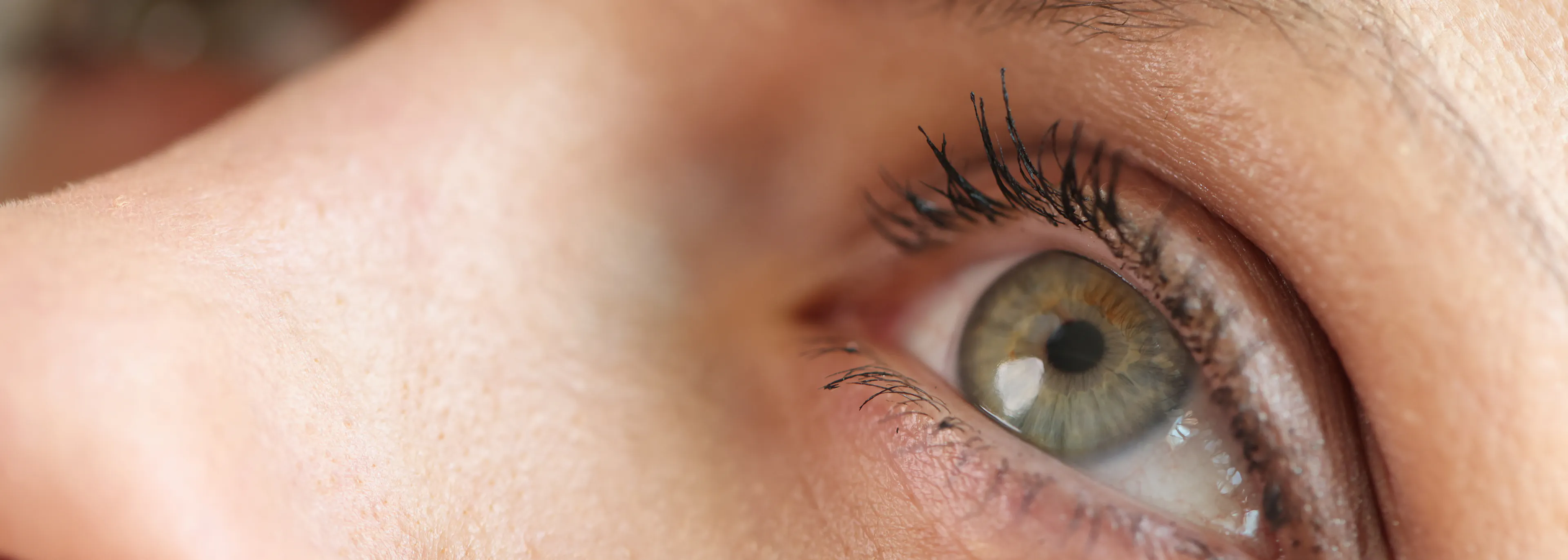 solutions naturelles pour soulager la sécheresse oculaire