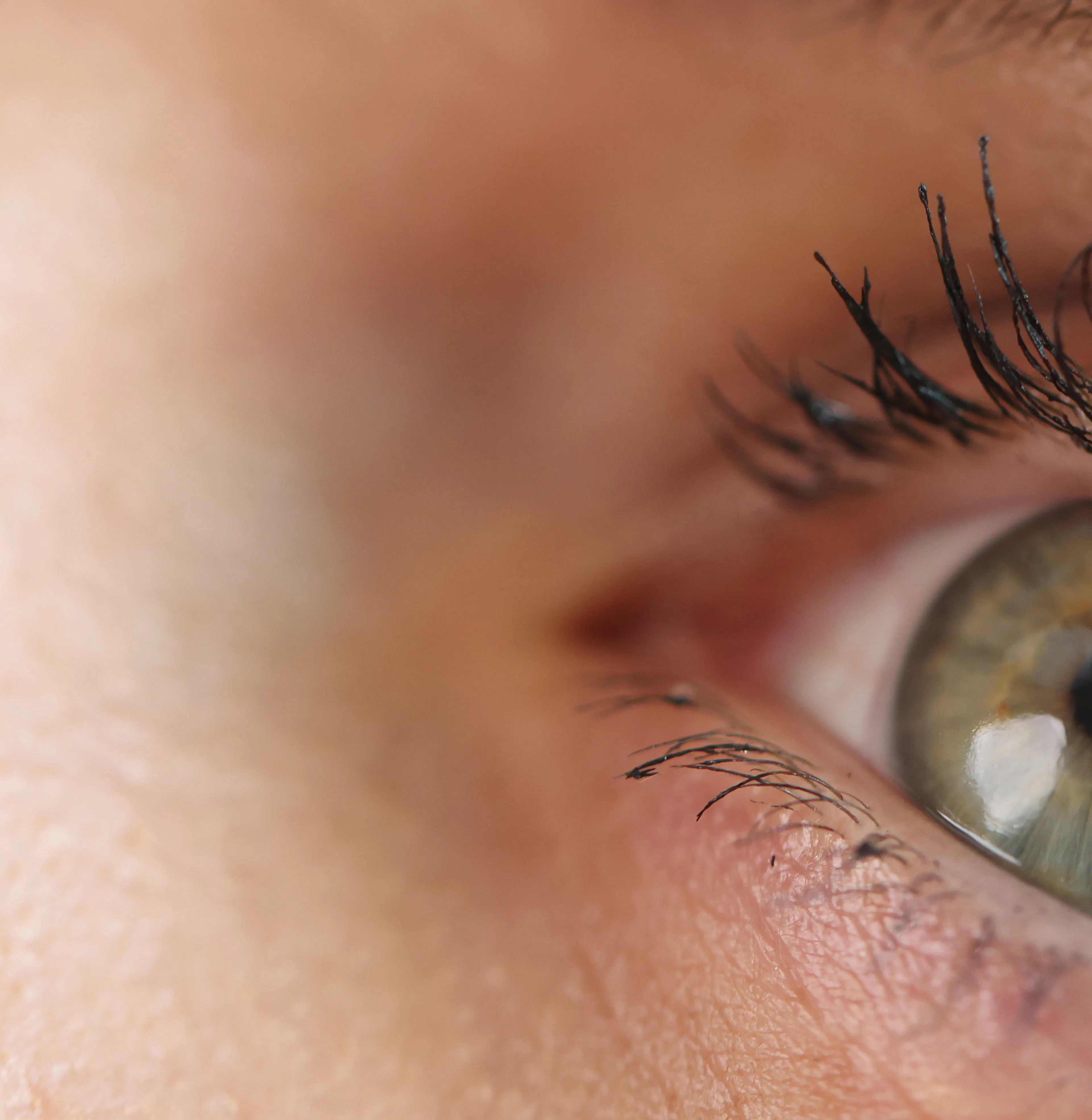 solutions naturelles pour soulager la sécheresse oculaire