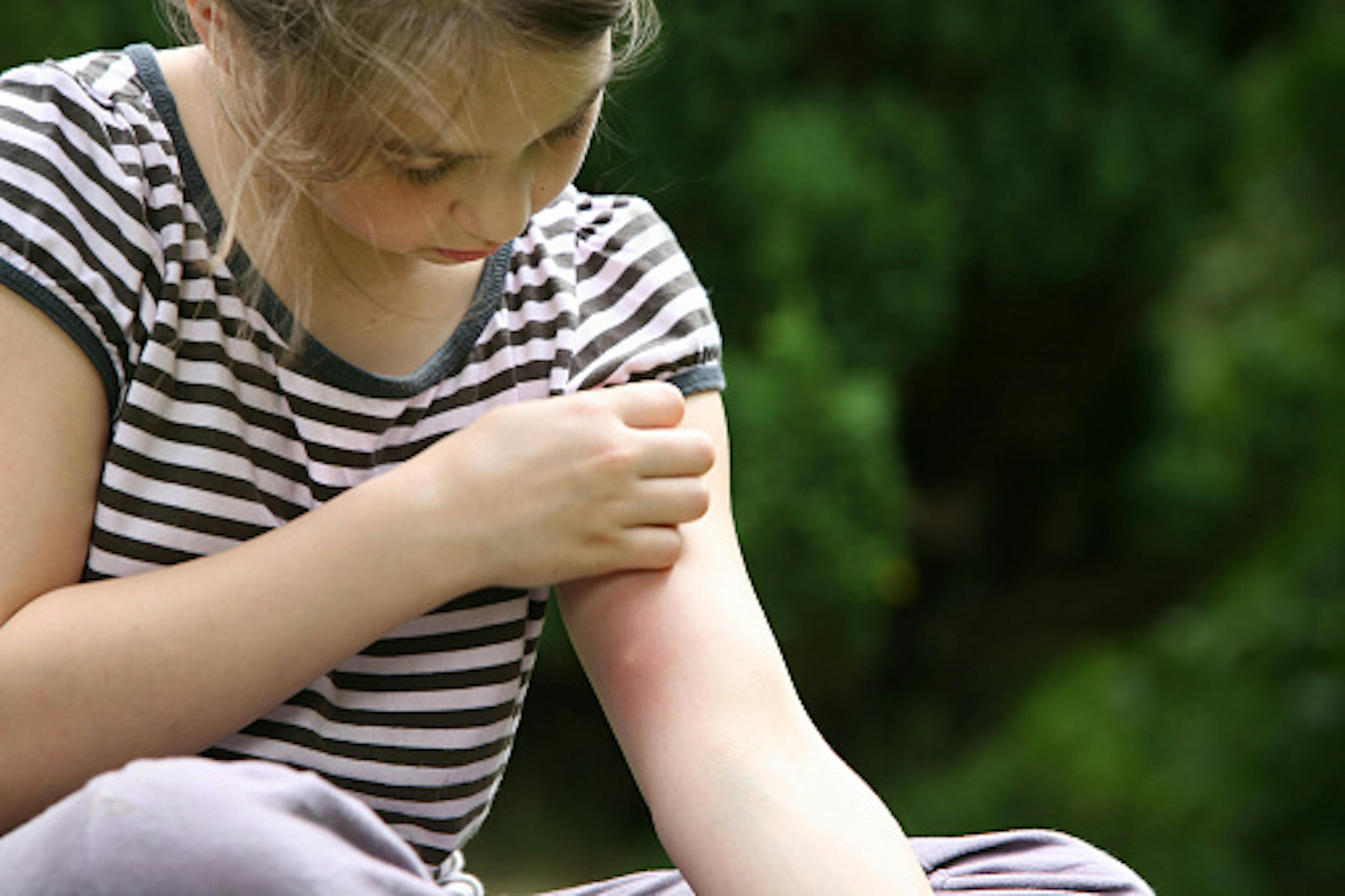 Piqures d'insectes enfants Boiron