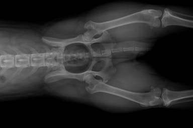 Hip x ray