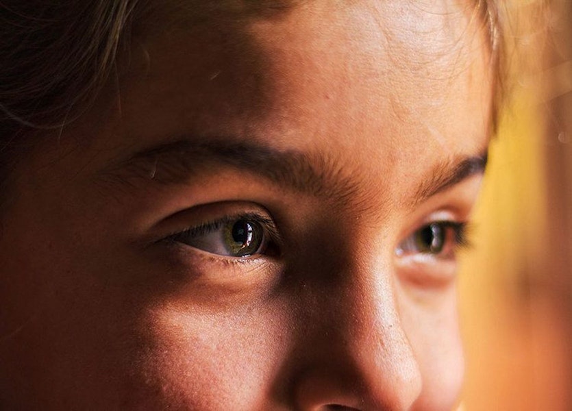 Pinkeye In Children