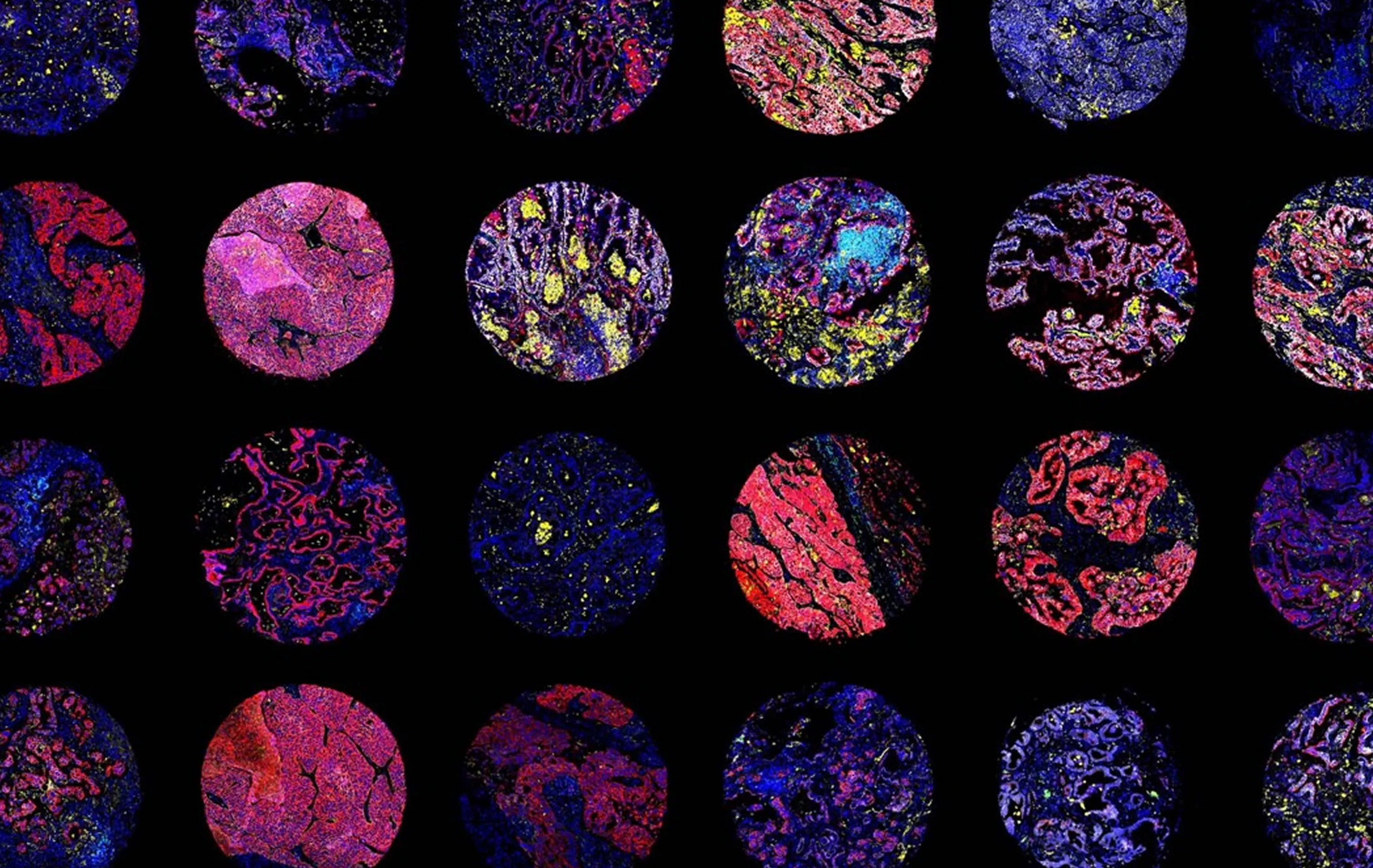 Grid of stained tissue microarray samples