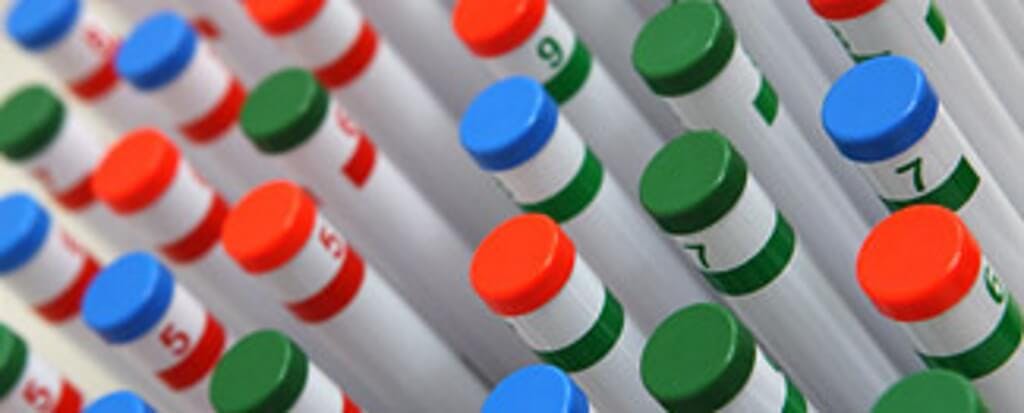 Test tubes with blue, green and red caps.