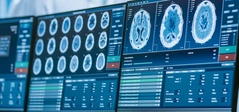 Neurological brain scans on a computer