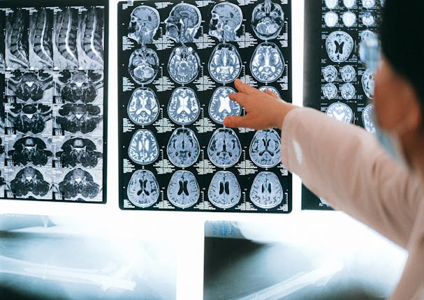 Doctor pointing at neurological brain scans on a light board