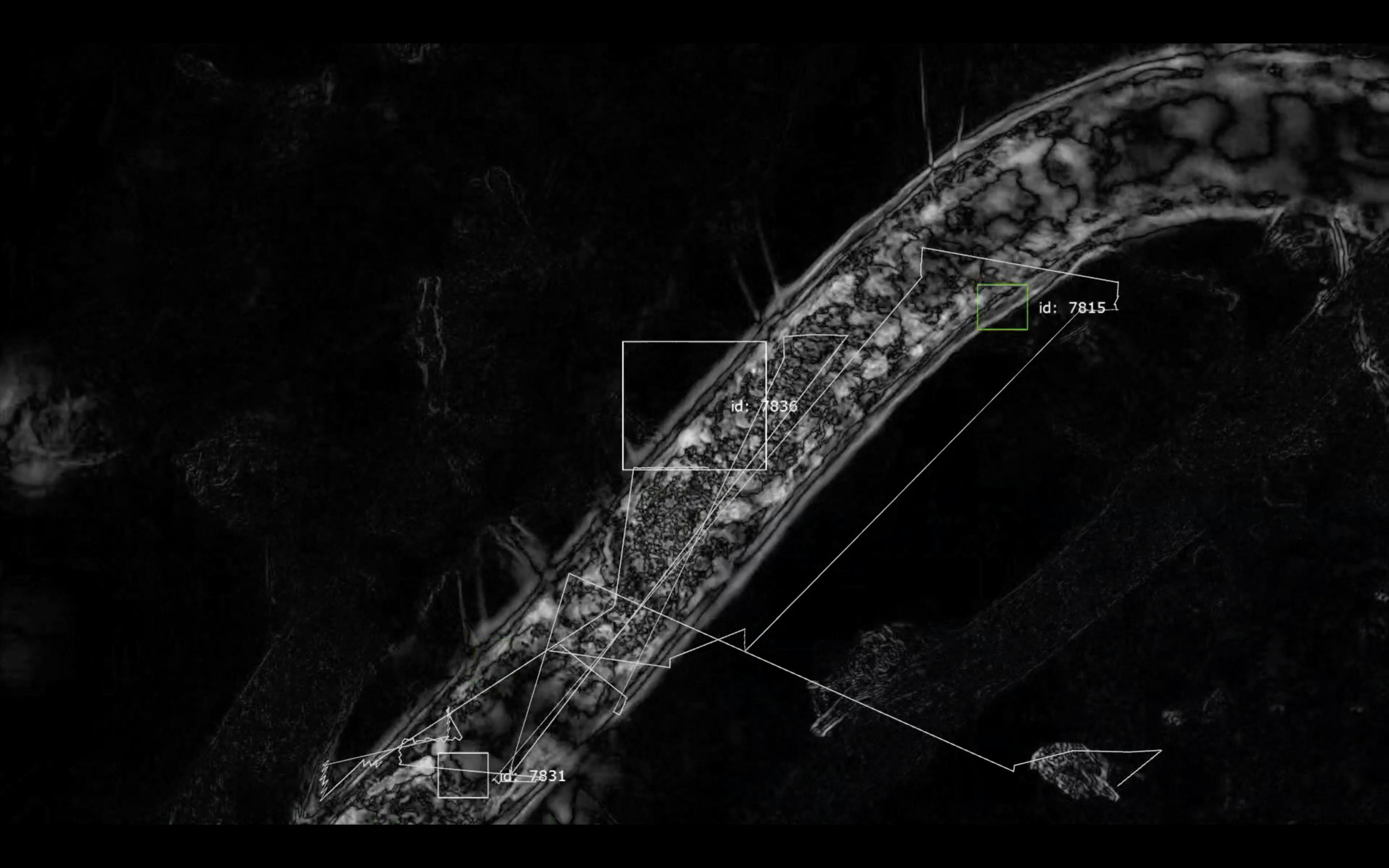 A monochrome image of bacteria under a microscope with software identifying parts of the image