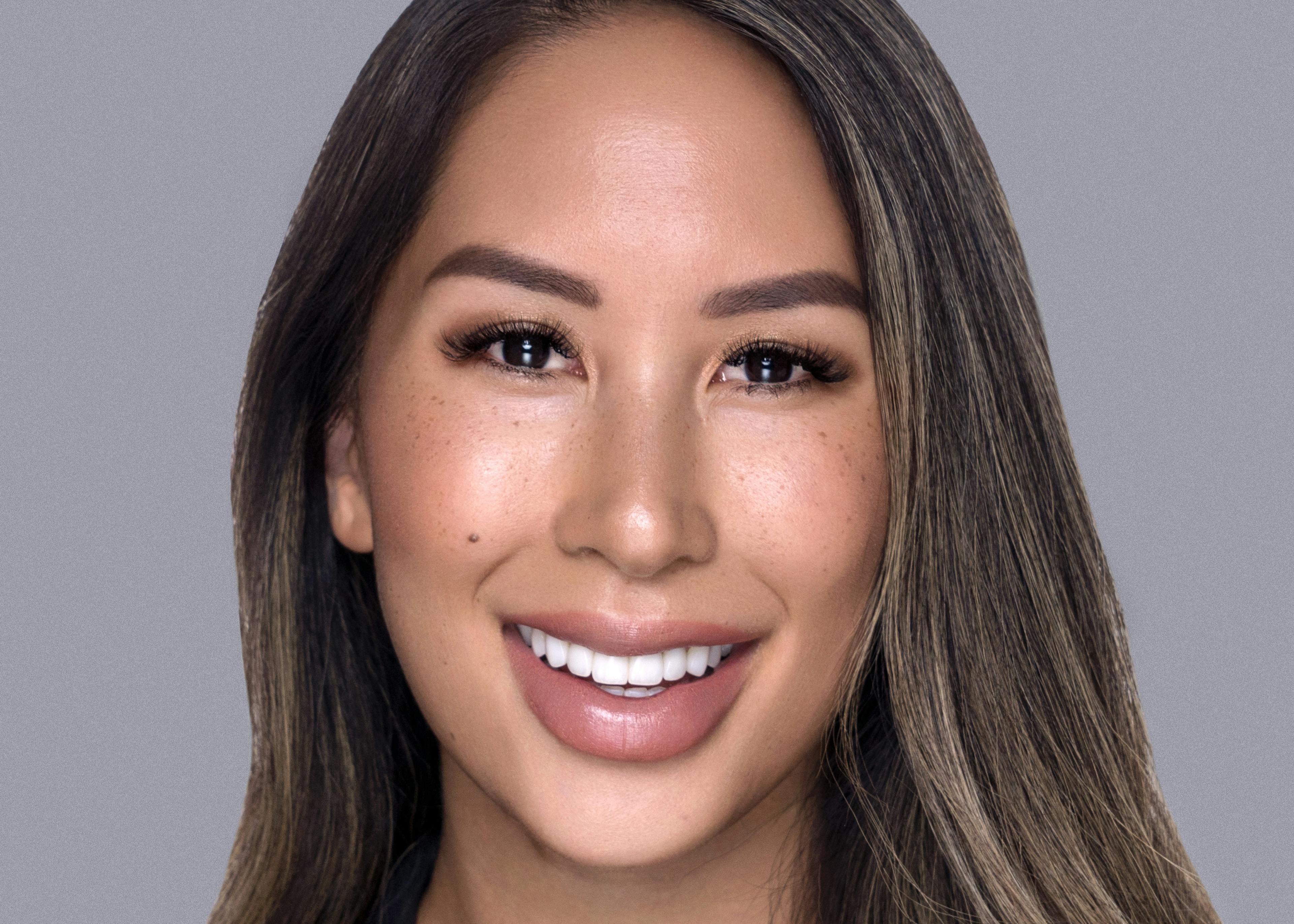 Intan Lay after smile makeover at Vogue Dental Studios.