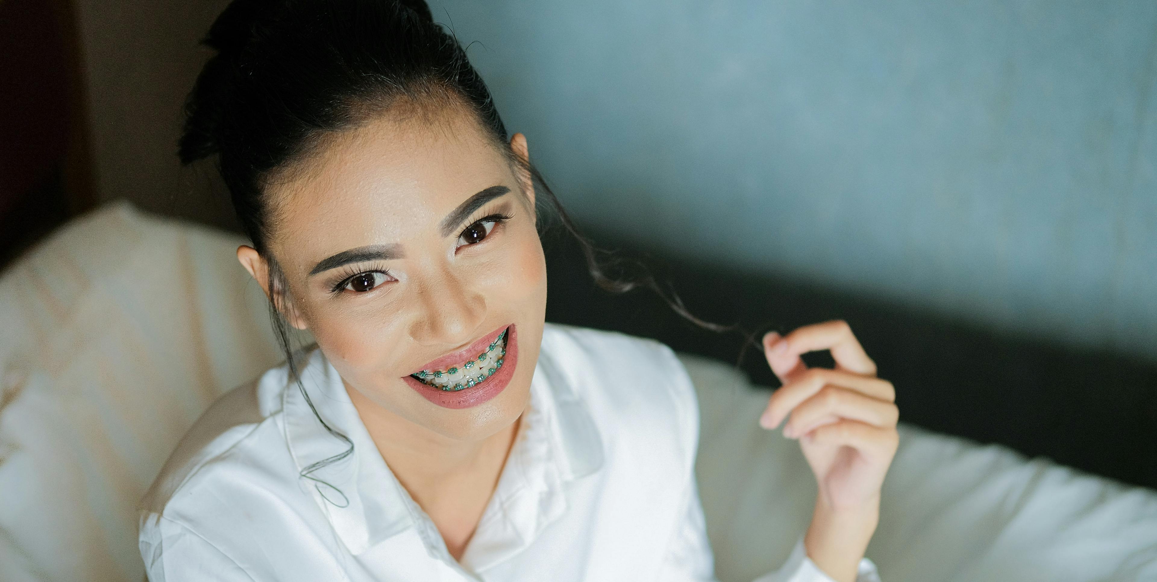 It doesn't stop after braces