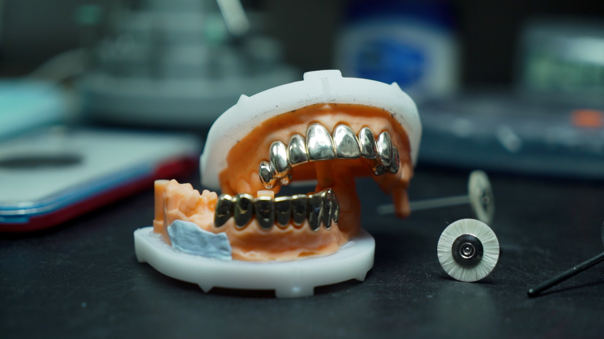 The Rise of Gold Veneers and Crowns Vogue Dental Studios Blog