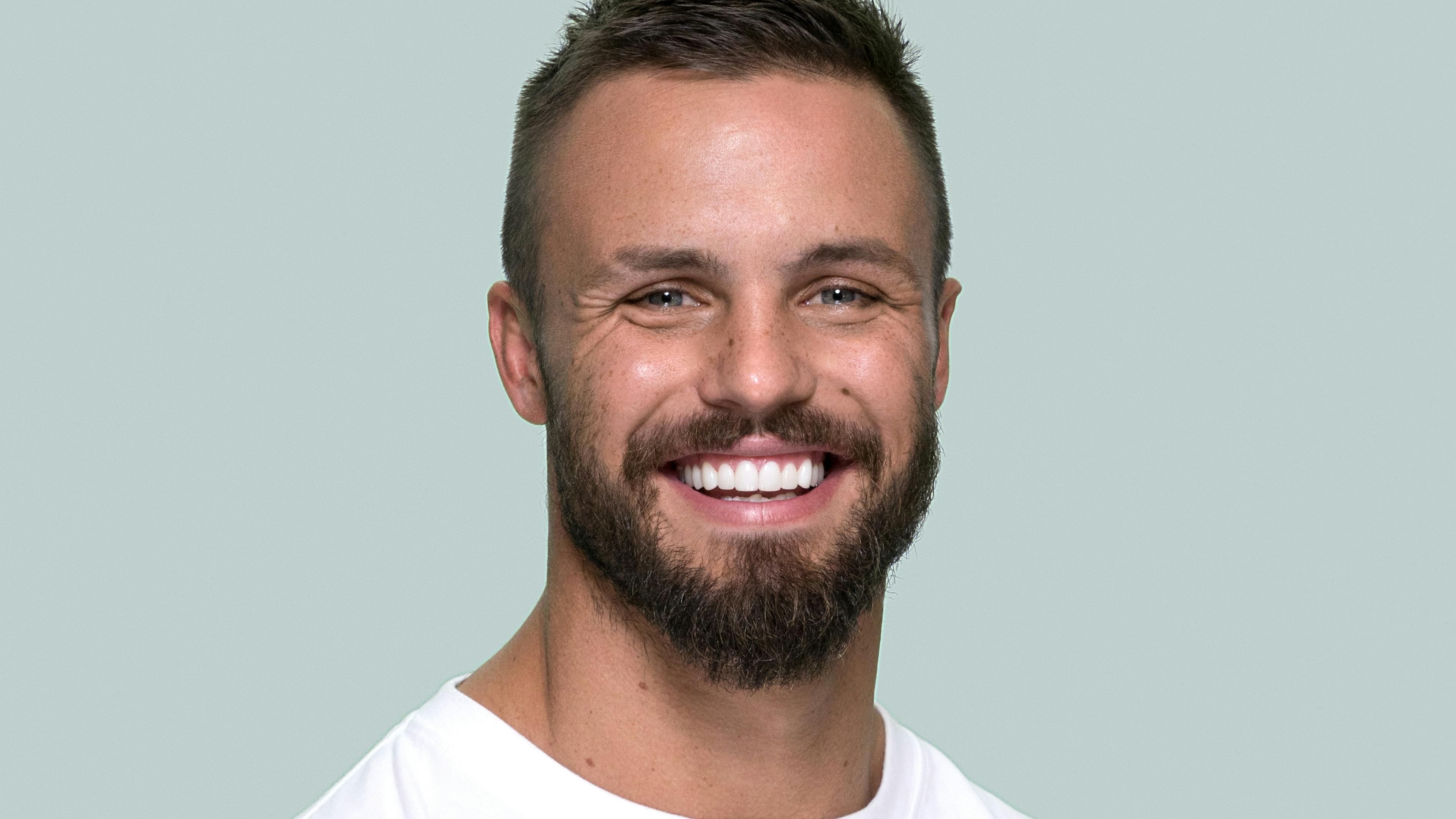 Sandor Earl, Australian footballer, with porcelain veneers.