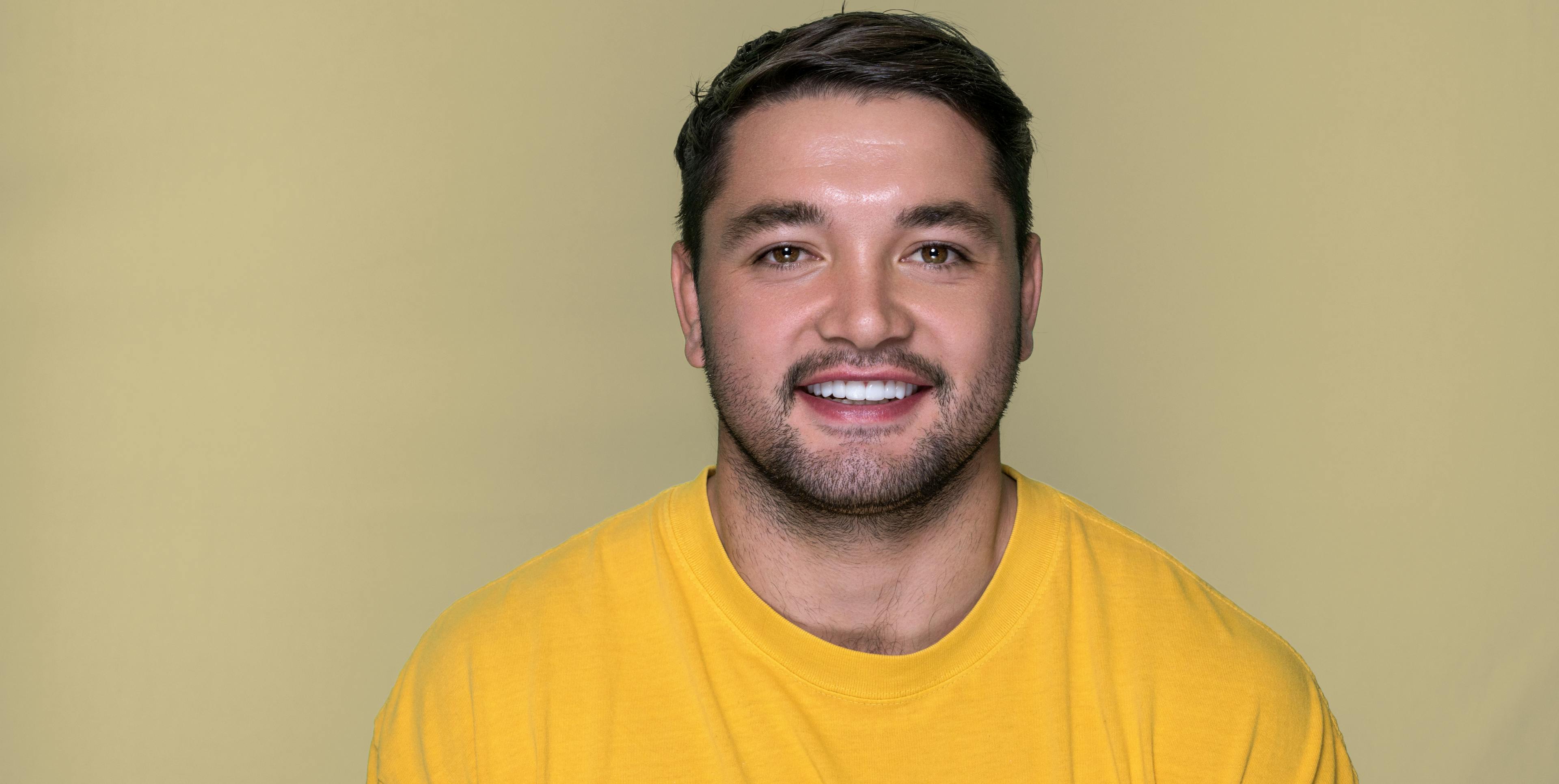 How much do Porcelain Veneers cost in Melbourne?