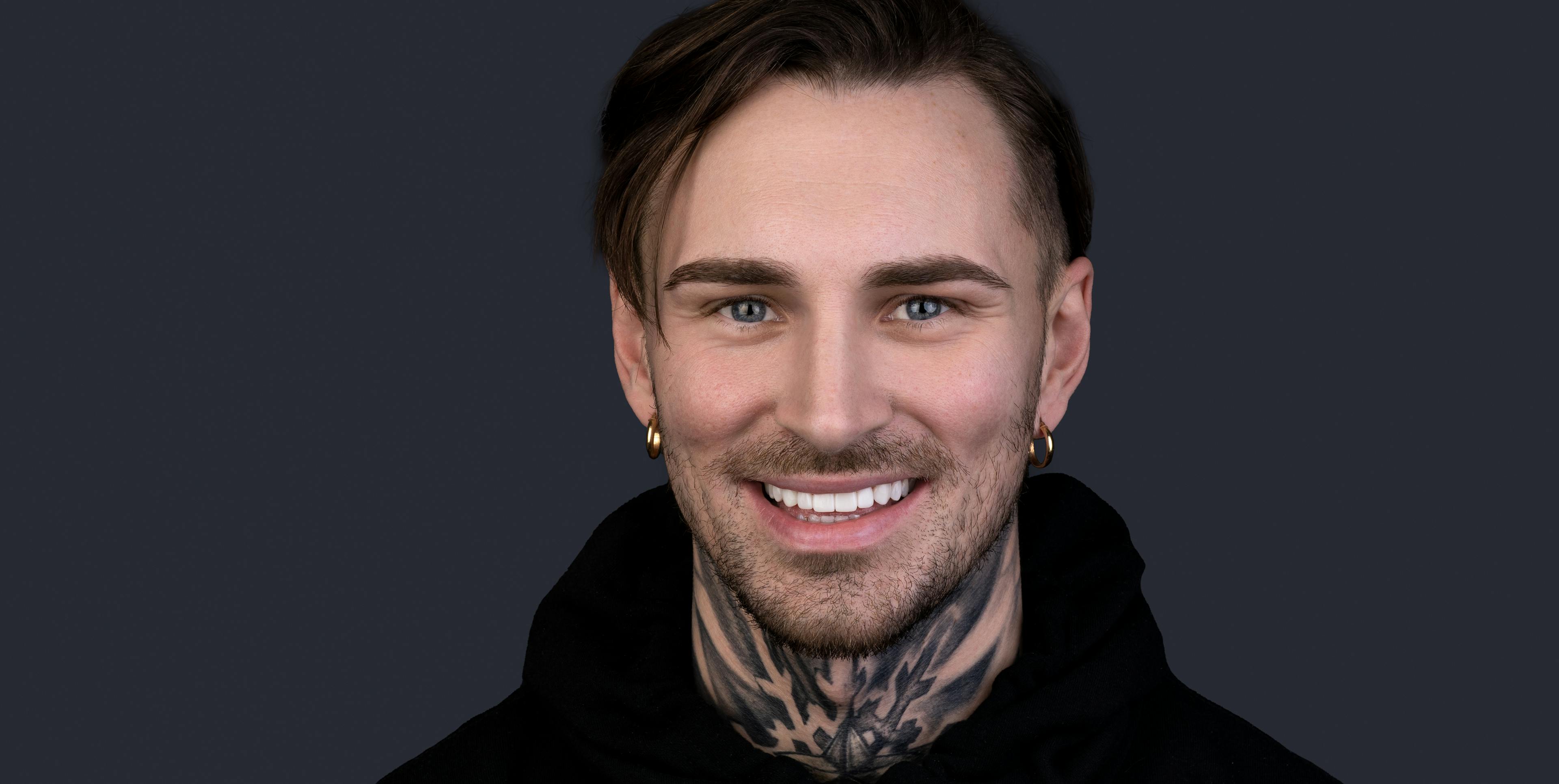 Hybrid Veneers vs. Porcelain and Composite