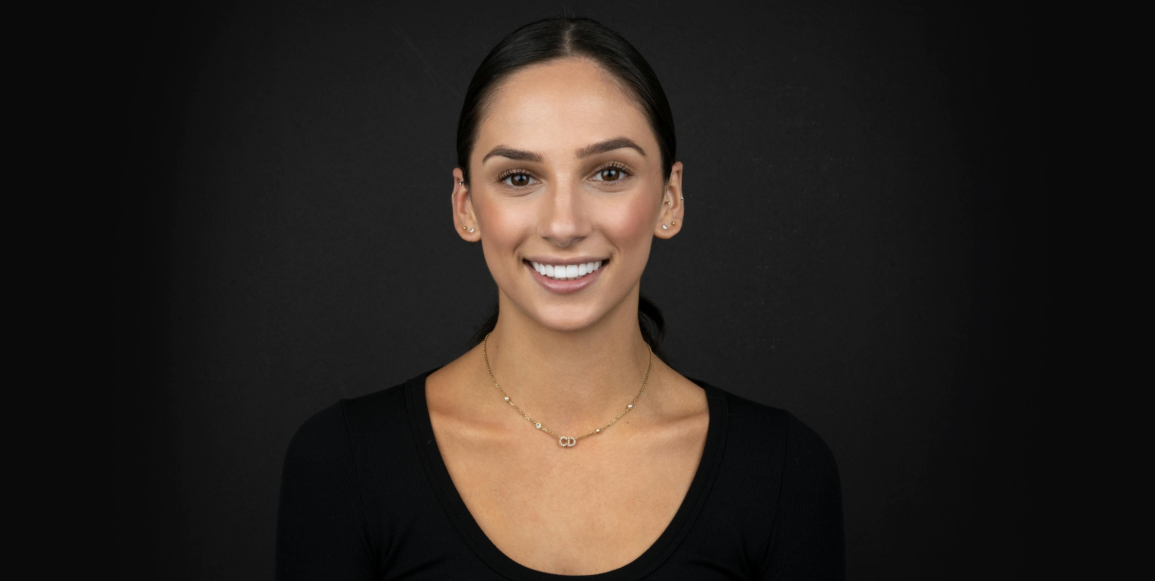 Preserving Perfection: Do Veneers Stain?