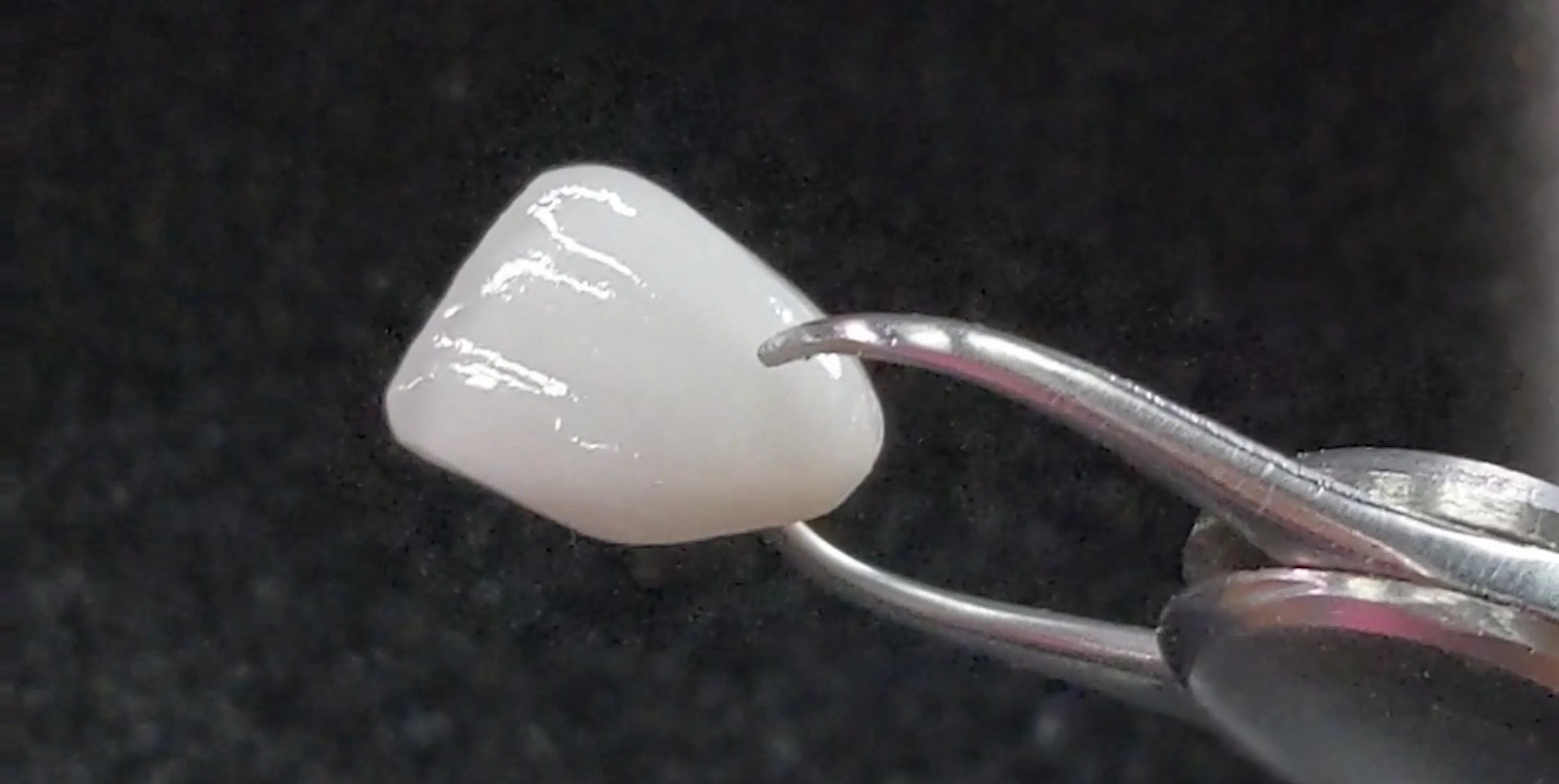 How much do porcelain veneers cost in Sydney?