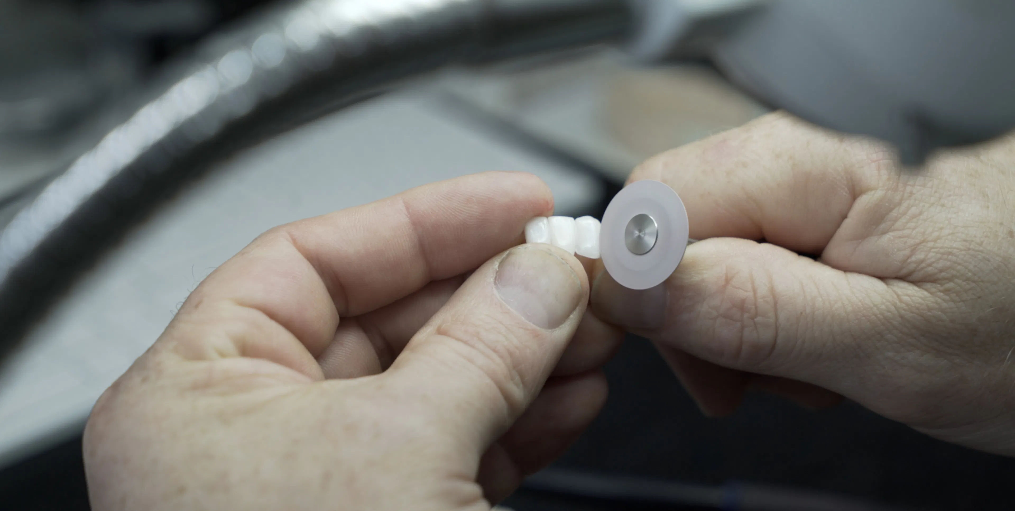 Do my teeth need to be shaved in order to get veneers?