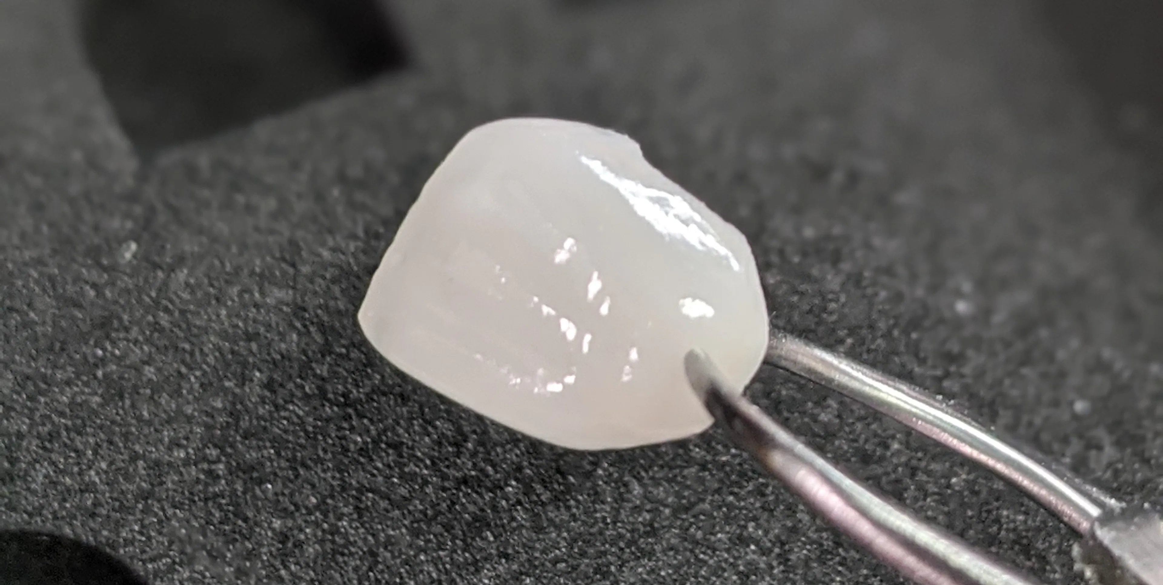 How much do Porcelain Veneers cost in Melbourne?