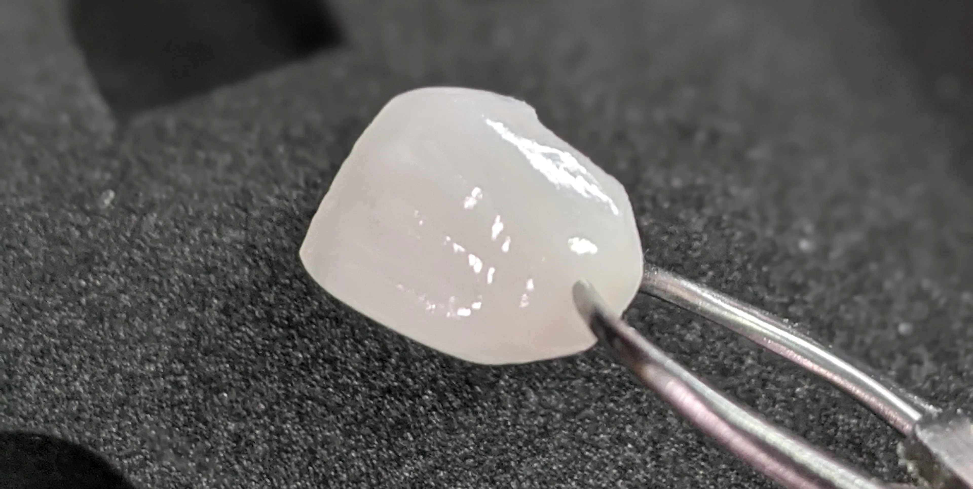 Can porcelain veneers fall off?