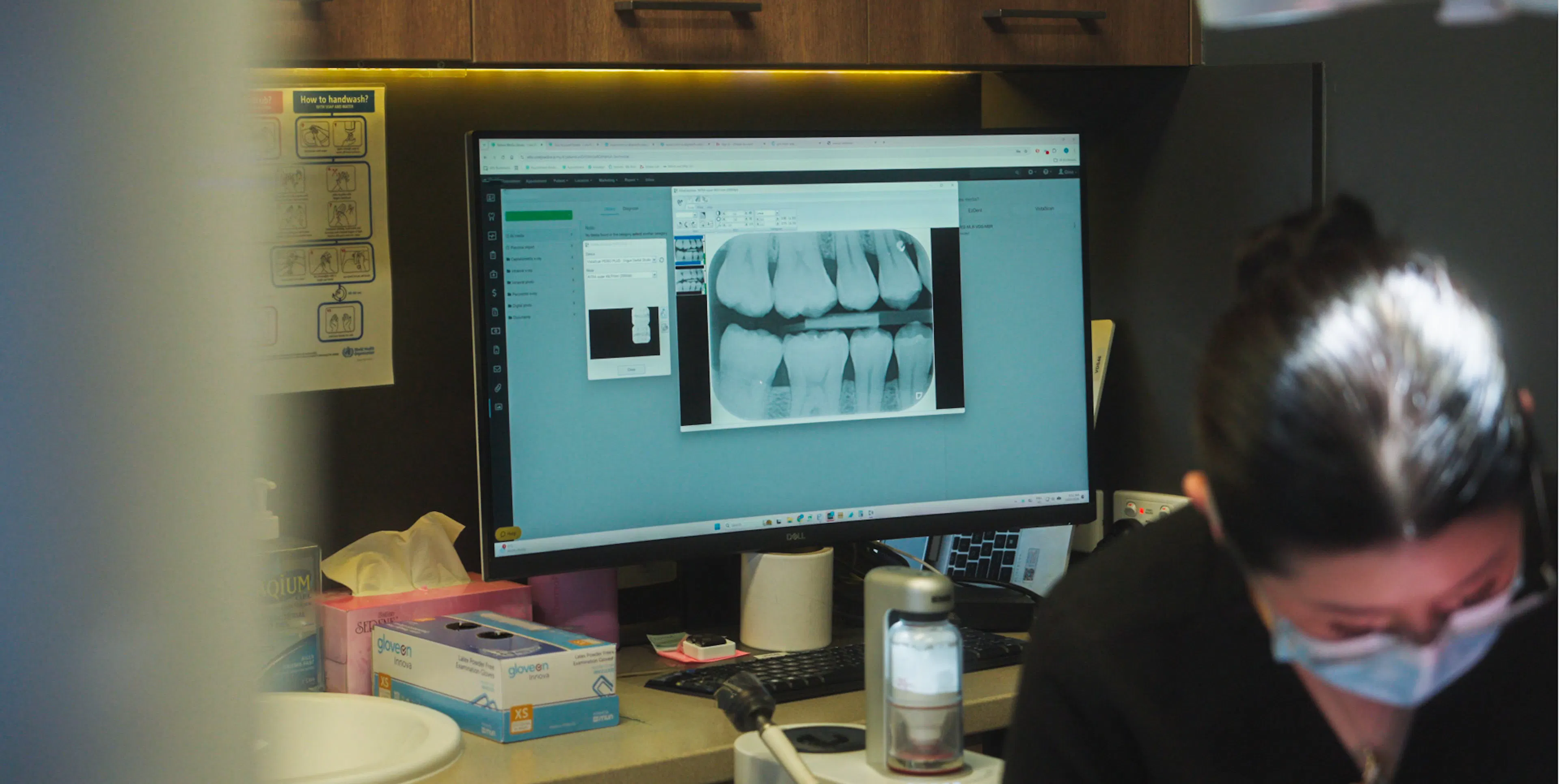 The Daily Grind: Managing Teeth Grinding and Bruxism