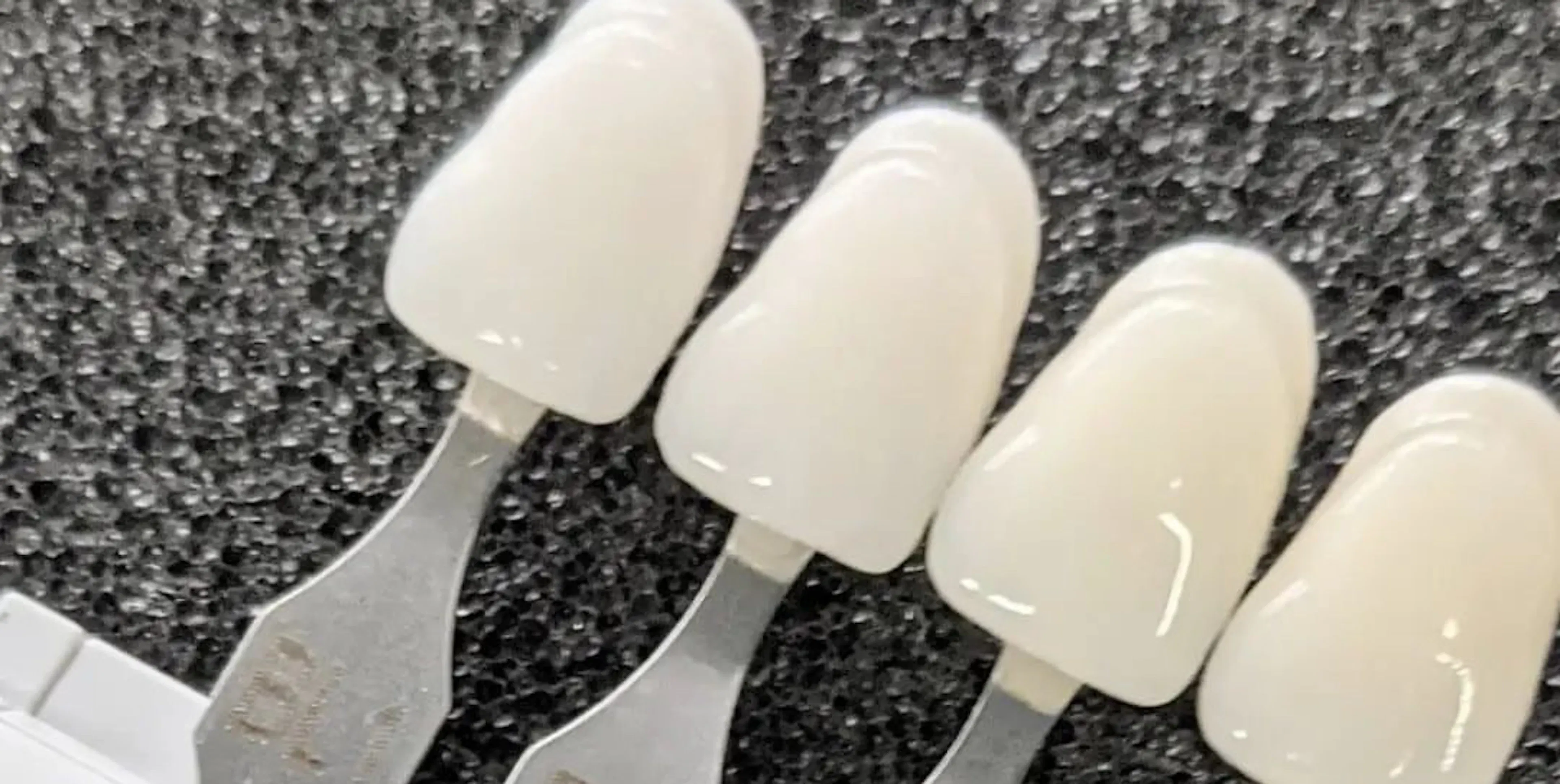 Can composite veneers be whitened?