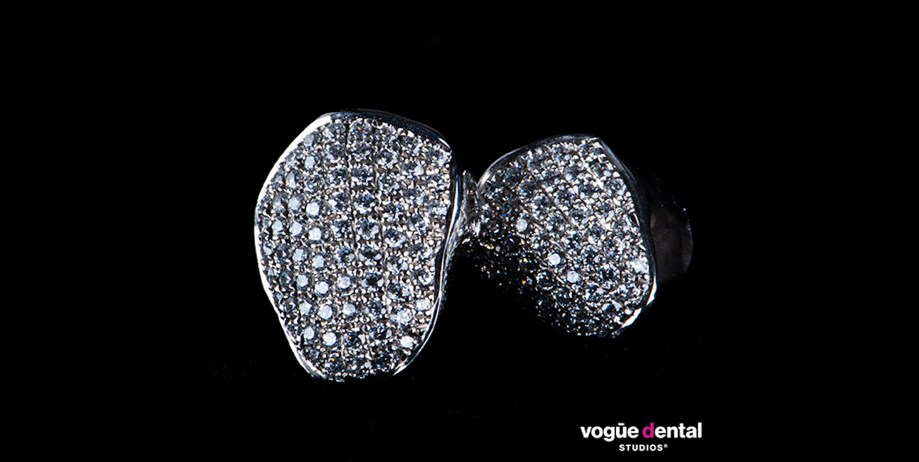The rise of diamond veneers, crowns, and grills