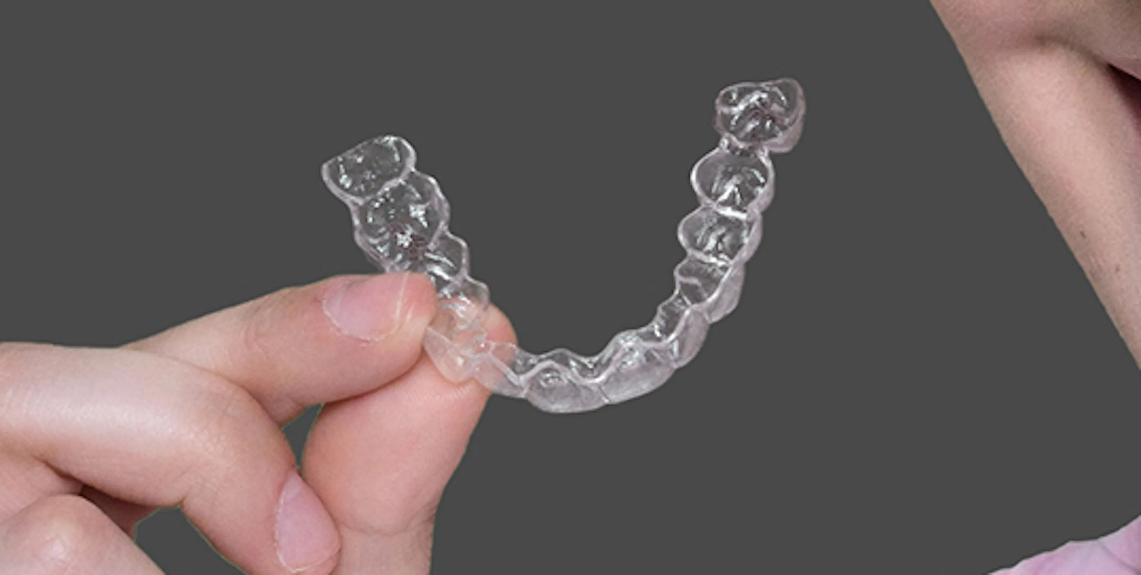 Let’s talk about retainers, Baby.