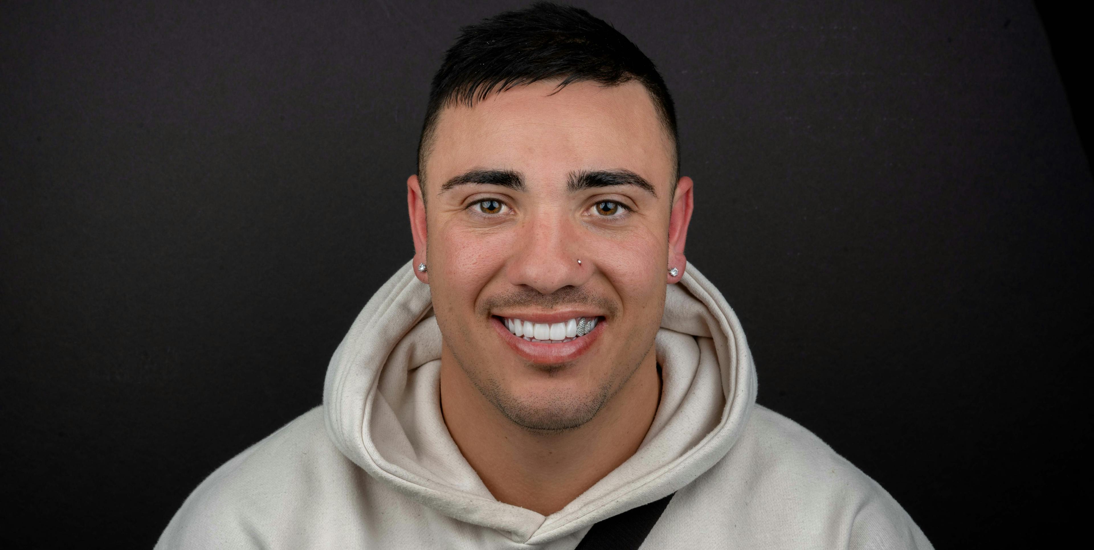 The rise of diamond veneers, crowns, and grills