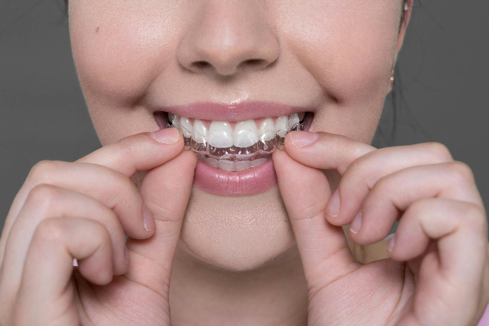 Woman holding Invisalign clear aligners up to her smile