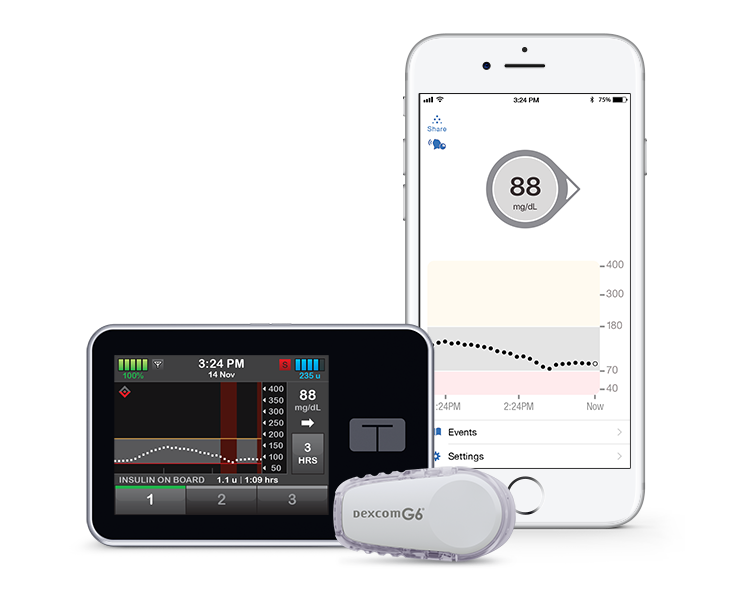 ccs medical dexcom