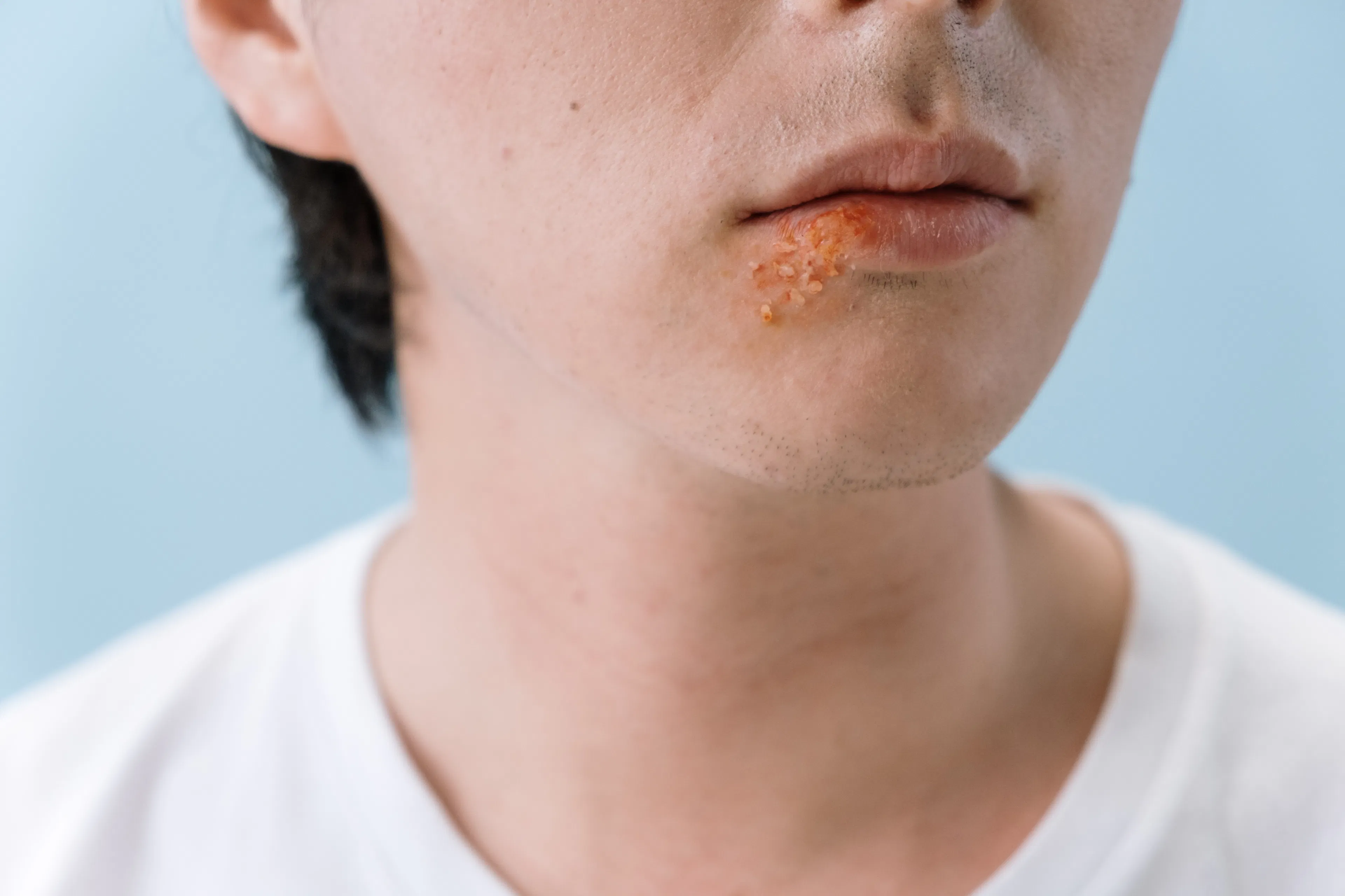 CEDH - Dermatologie