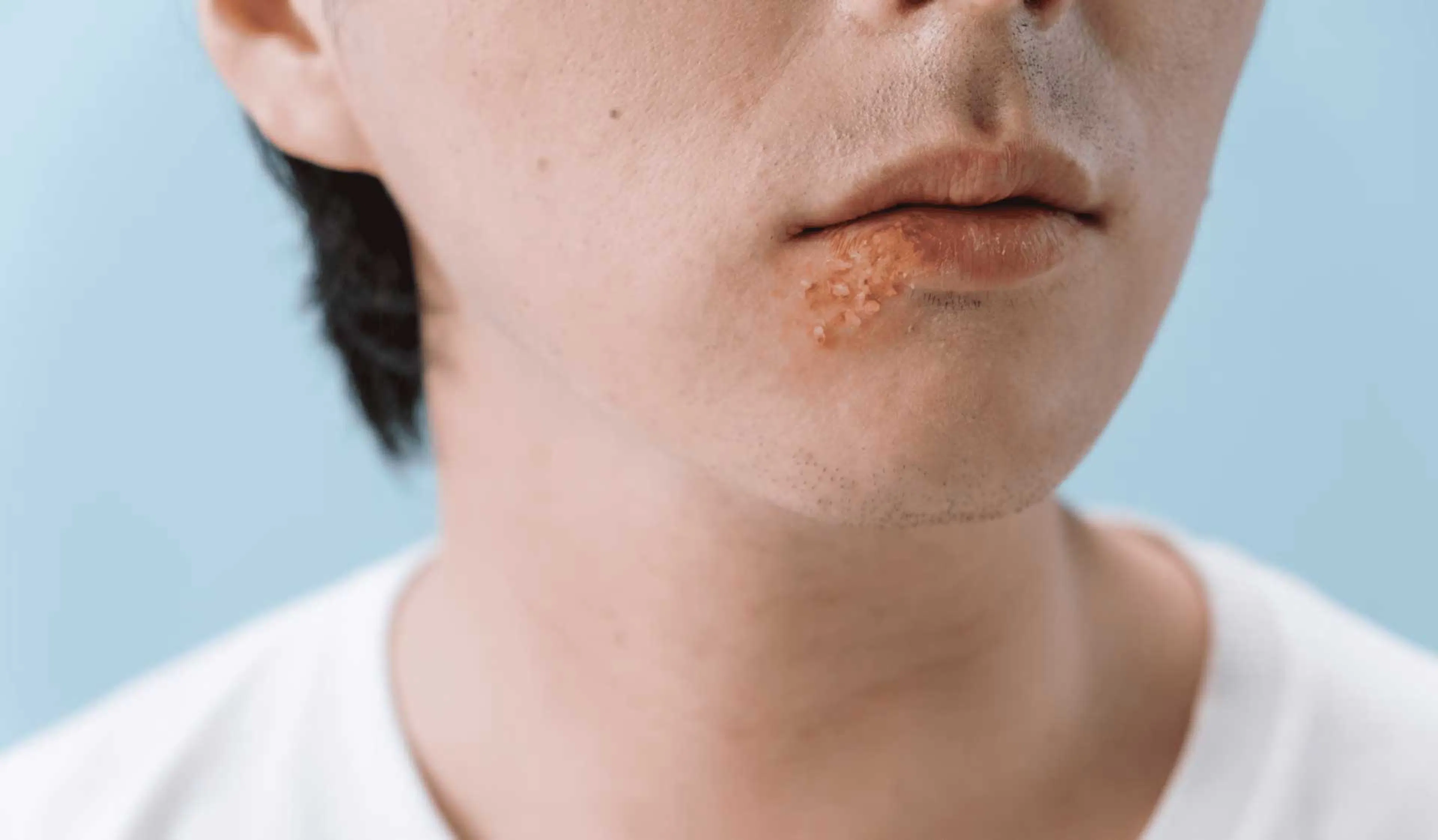 MTH_Dermatologie