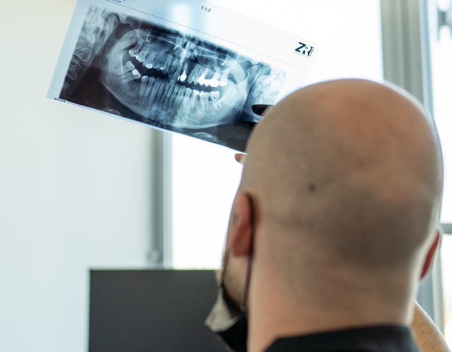 liječenje-zubnog-živaca-osijek