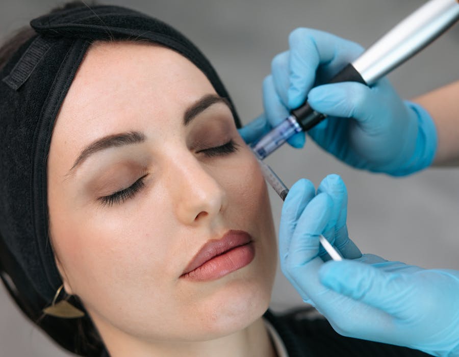 microneedling-cijena-ces-dental&estetic-osijek