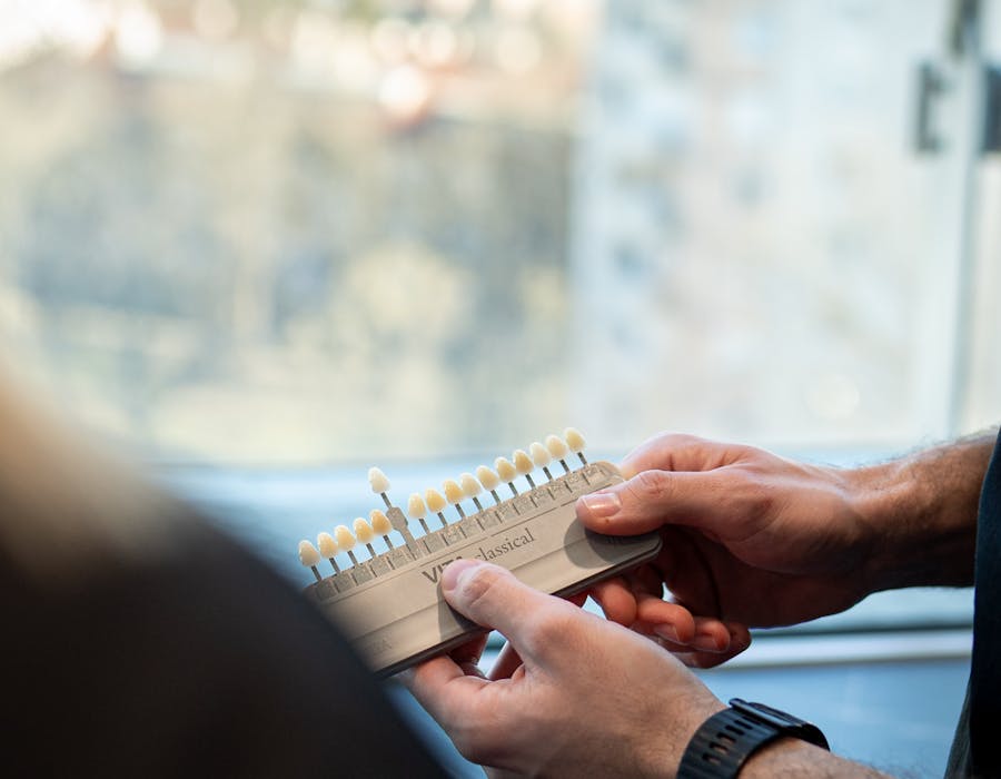 cirkonske-krunice-za-zube-iskustva