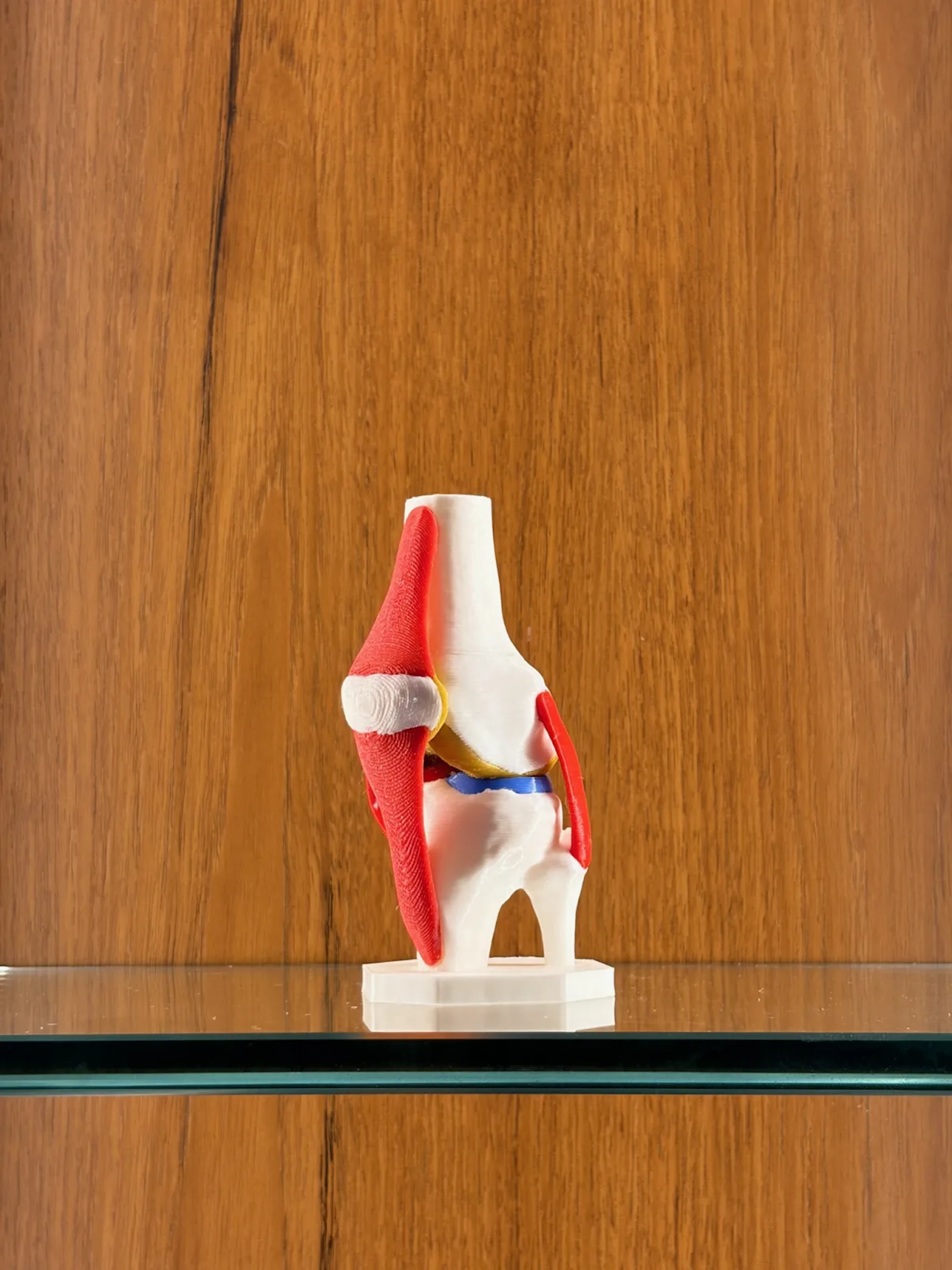 Anatomical knee joint model printed in red and white