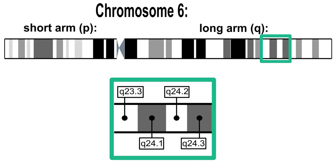 Chromosome 6 Deletion: Chromosome 6 Humain – RRUUZS