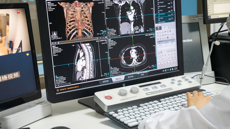 The outbreak of Covid-19 has increased digitalization in healthcare.
