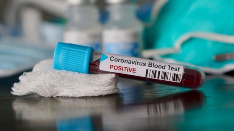 Coronavirus blood test- Positive