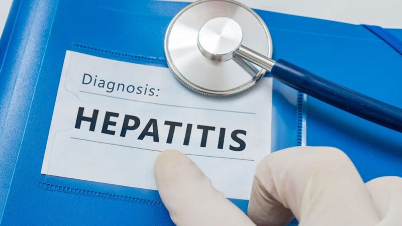 Medical equipment in diagnosing Hepatitis, a doctor wearing a glove and an inscription written hepatitis on it