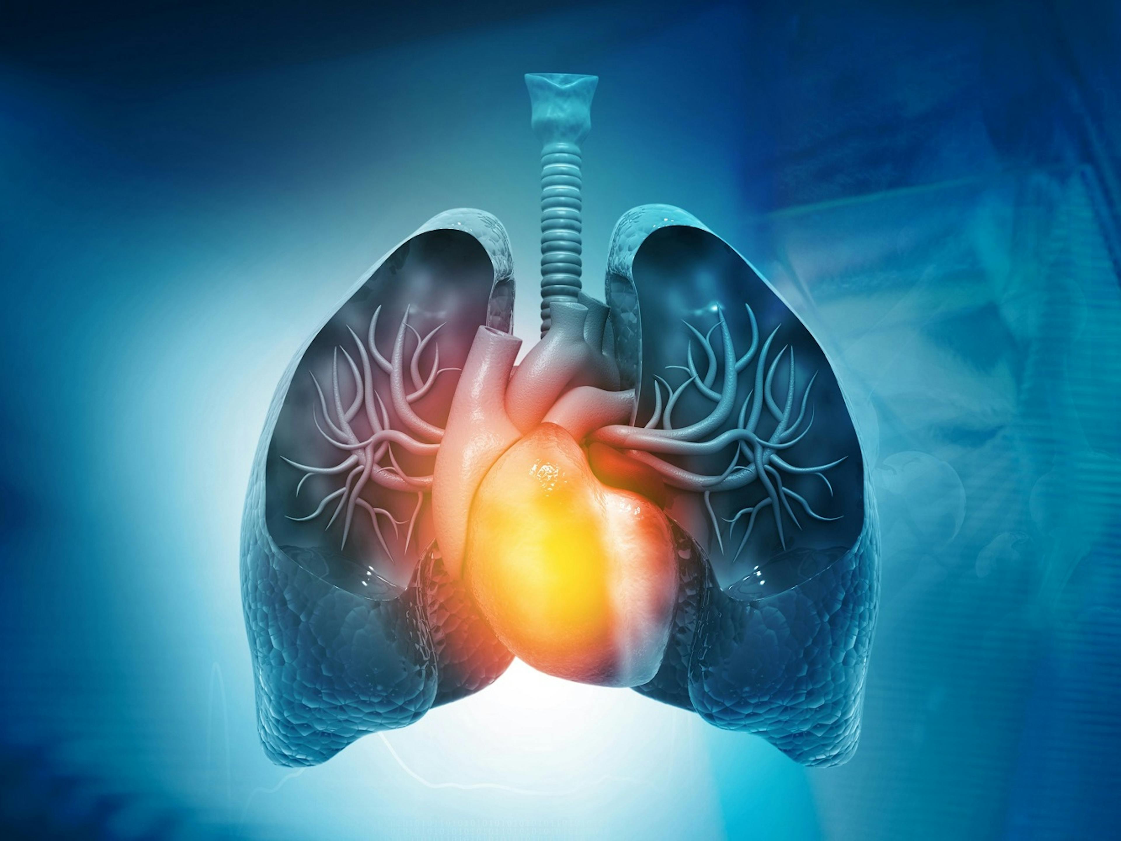 Does Medicare Cover a Lung Transplant?