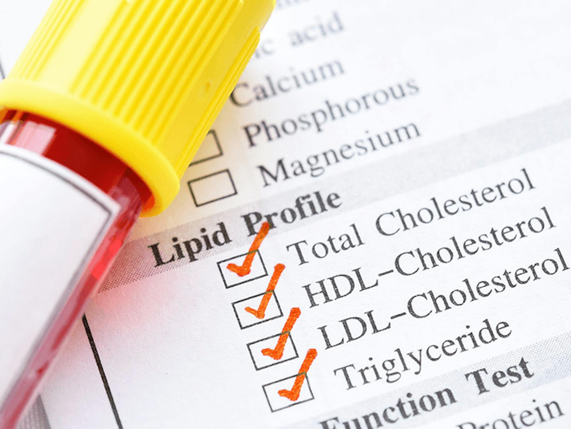 How Often Will Medicare Pay for a Lipid Panel? ClearMatch Medicare