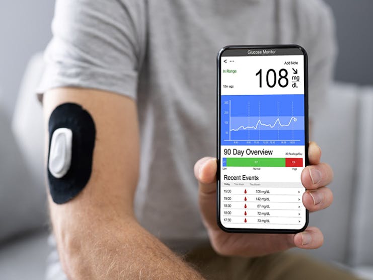 Does Medicare Cover Dexcom G6