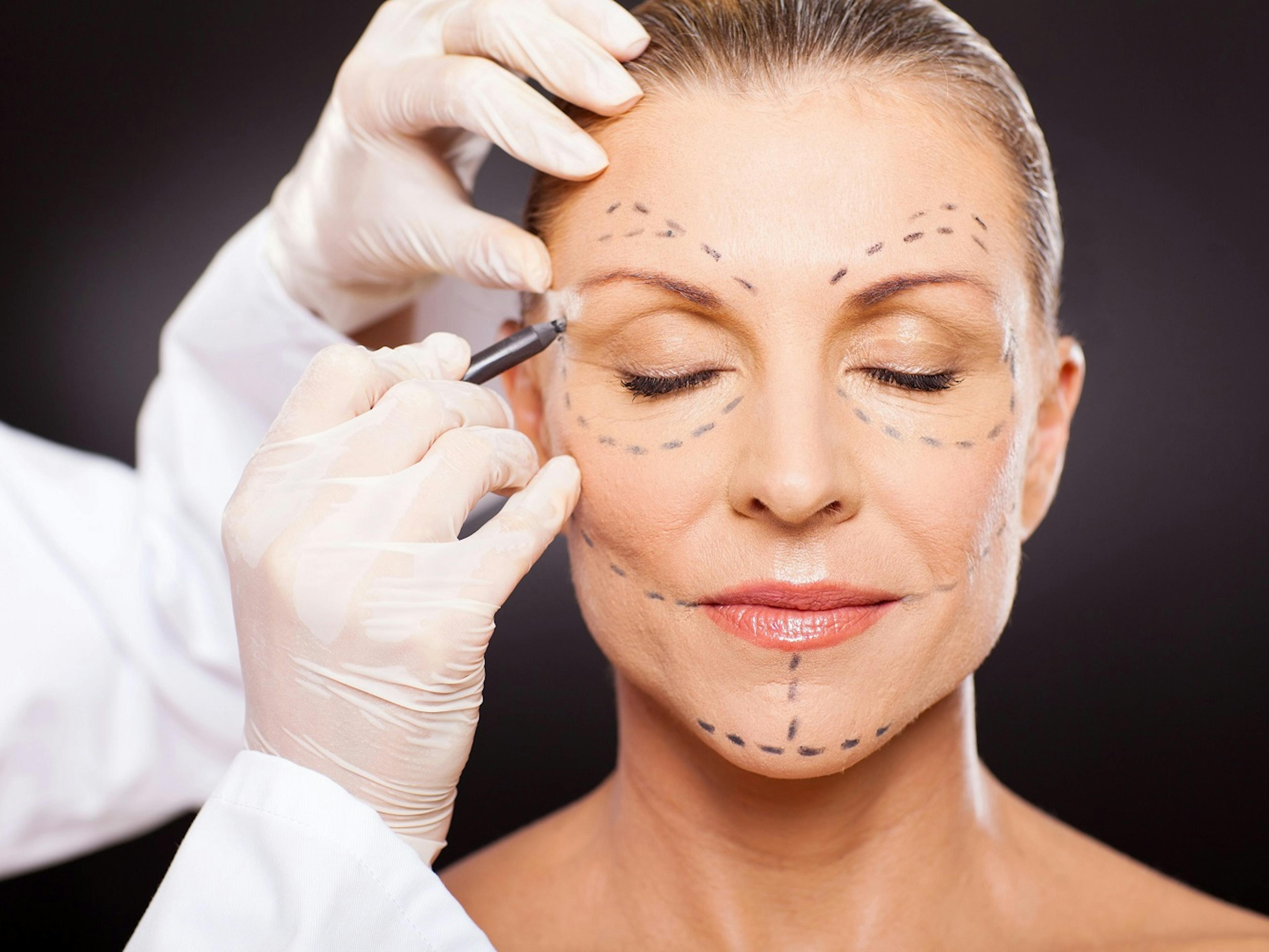 Does Medicare Cover Plastic Surgery?