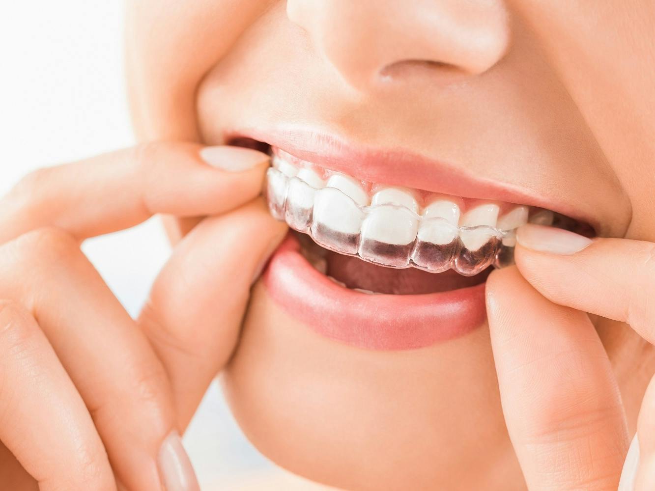 Does Medicare Cover Invisalign