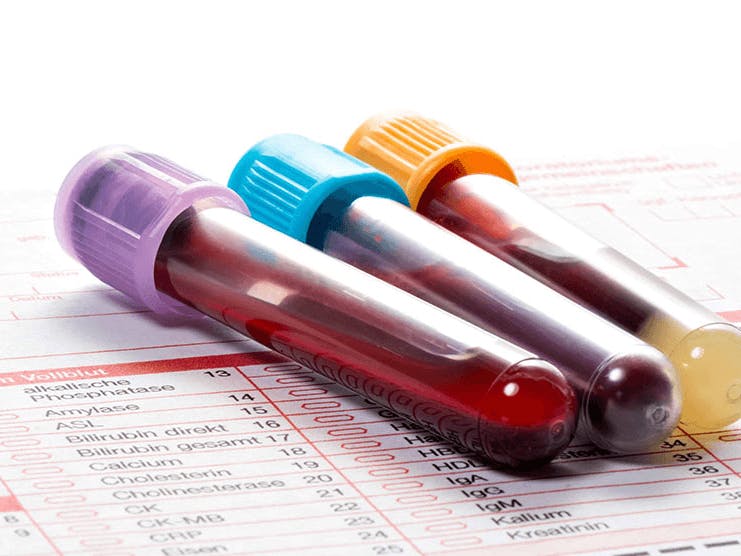 Medicare coverage for blood tests