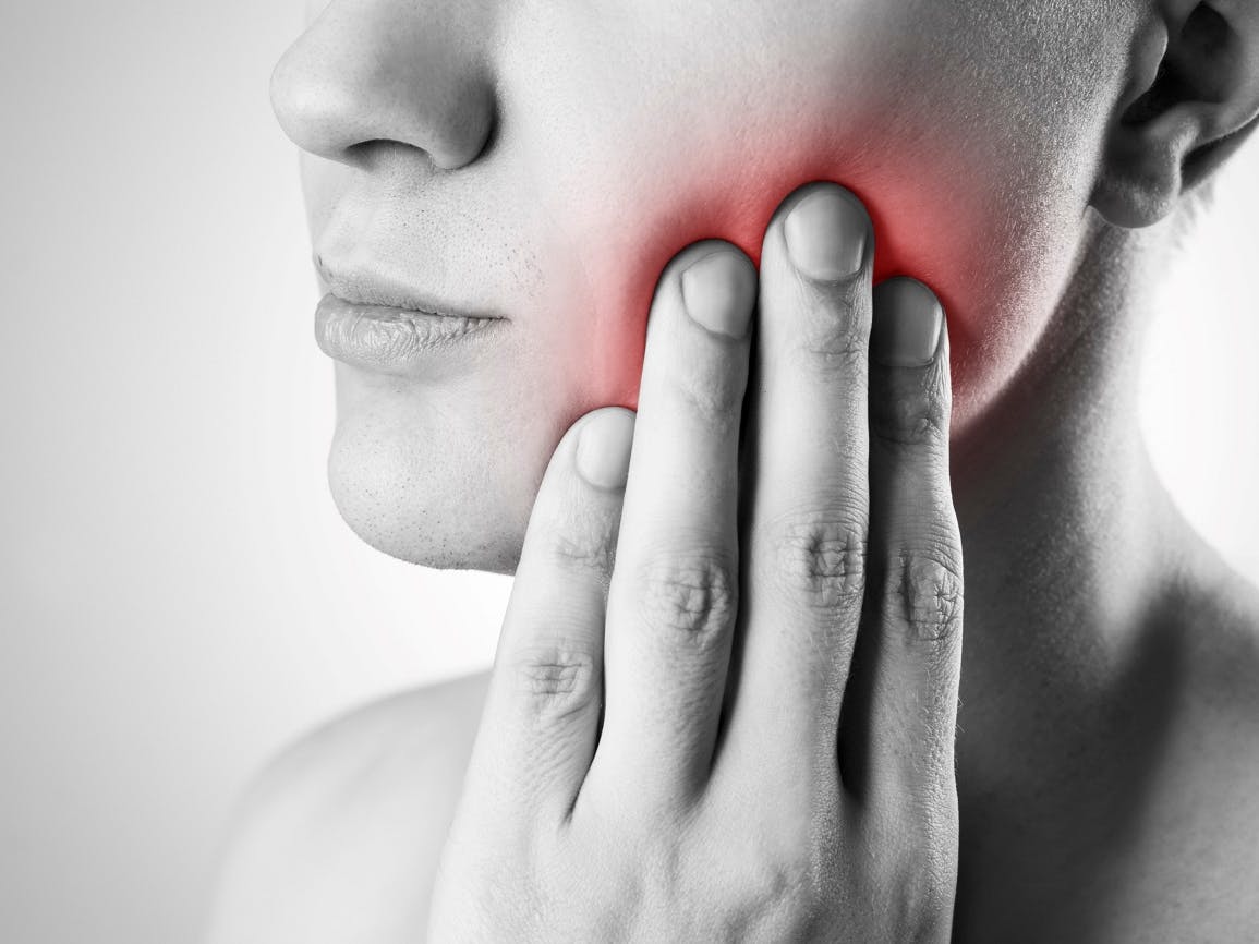 Does Medicaid Cover Wisdom Tooth Extraction?