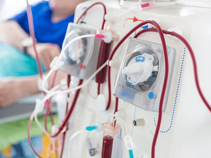 Does Medicare Cover Dialysis