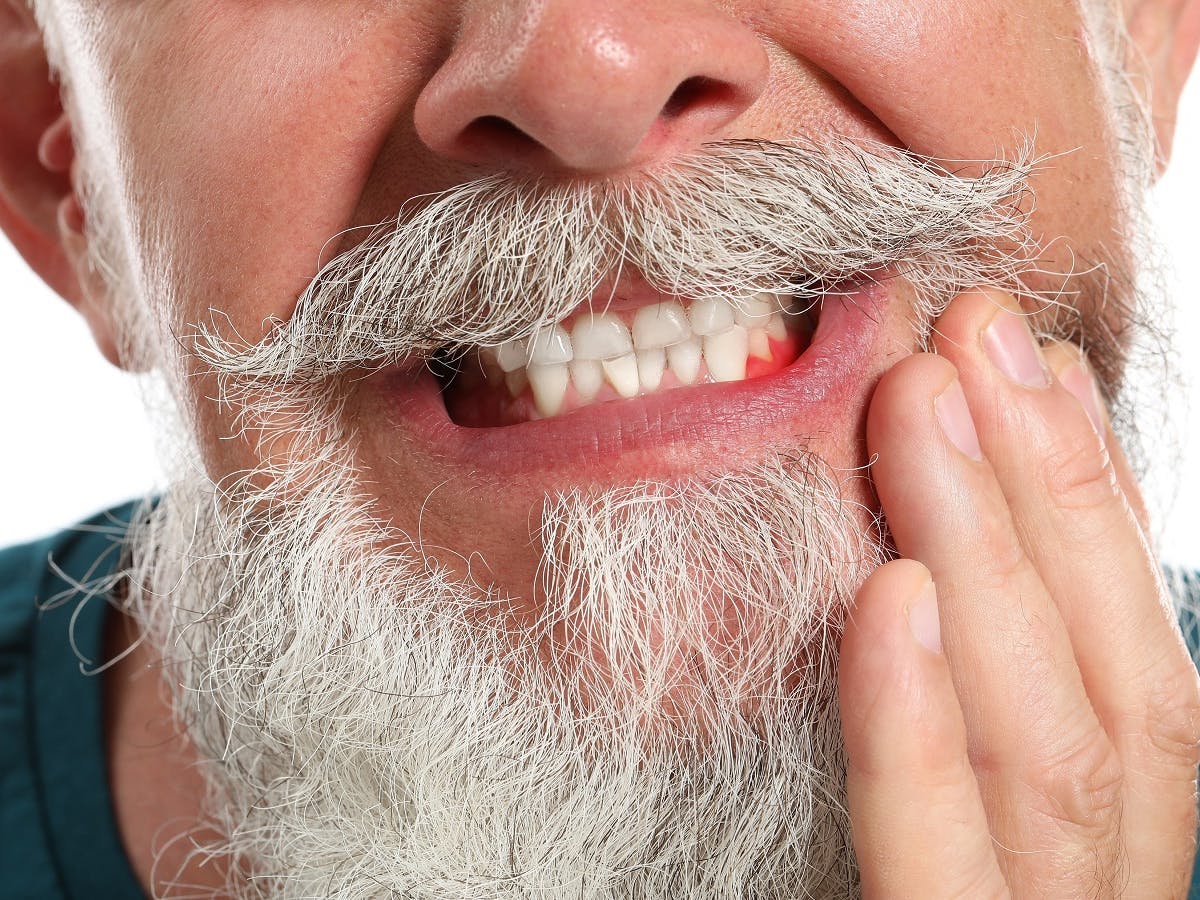 Gum Disease and Your Health