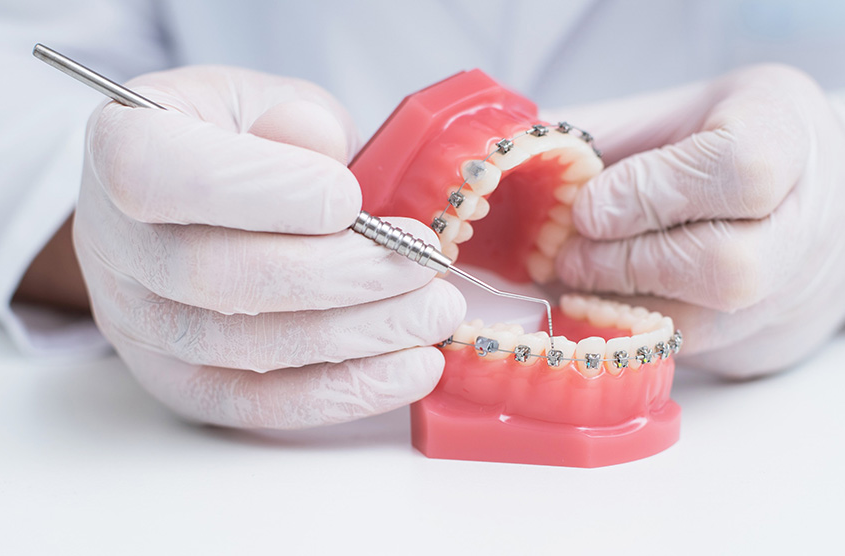 Does Medicare Cover Braces? | ClearMatch Medicare